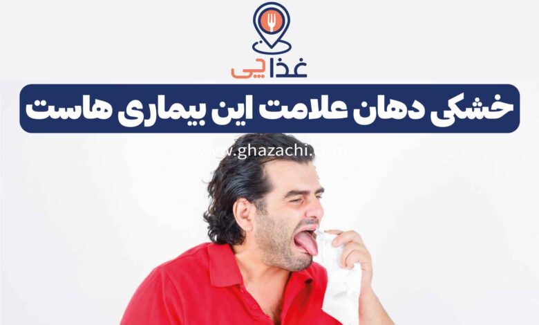 خشکی دهان علامت و نشانه ی این بیماری هاست